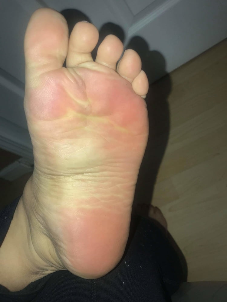 25 year old BBW mexican Soles Nut draining wrinkles #97818052