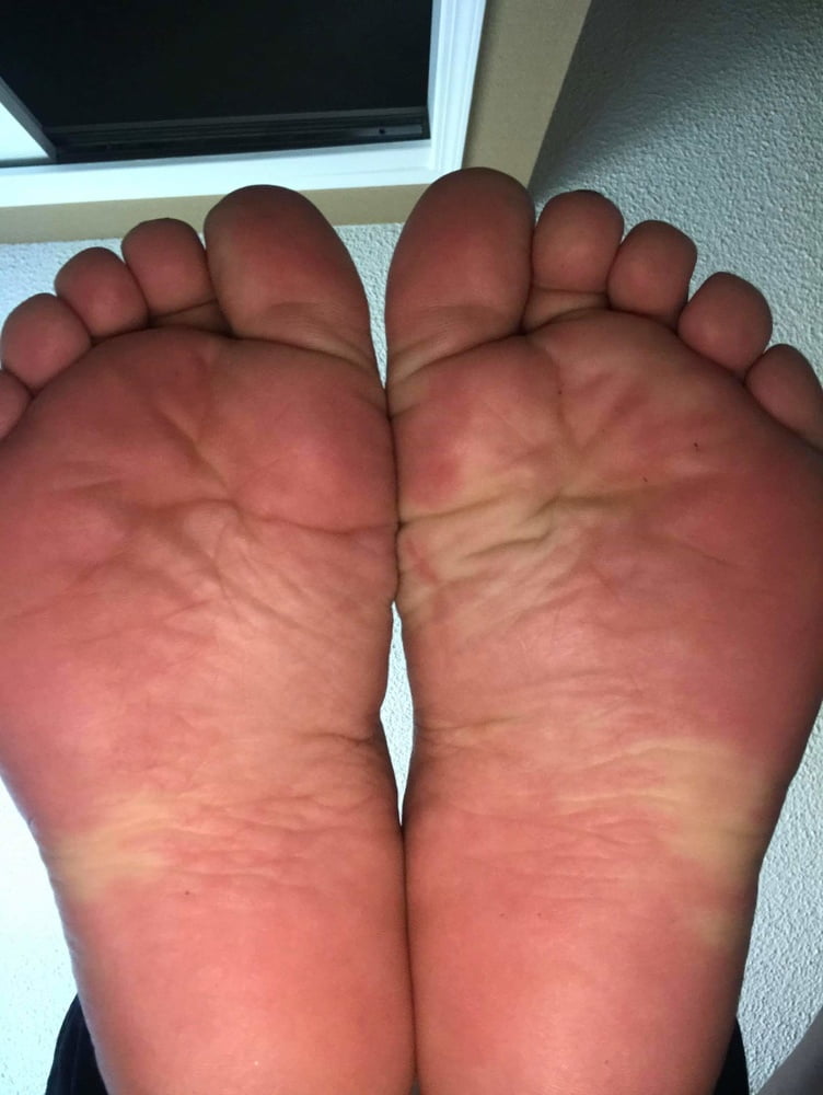 25 year old BBW mexican Soles Nut draining wrinkles #97818099