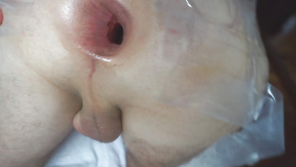 Anal gaping wide open asshole august 2015 #107340928