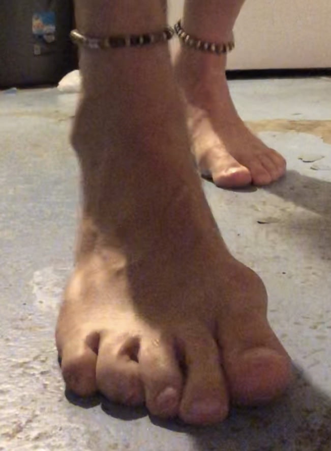 MISC #106654123
