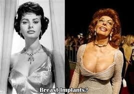 Classic Beauty : Sofia Loren #92929155