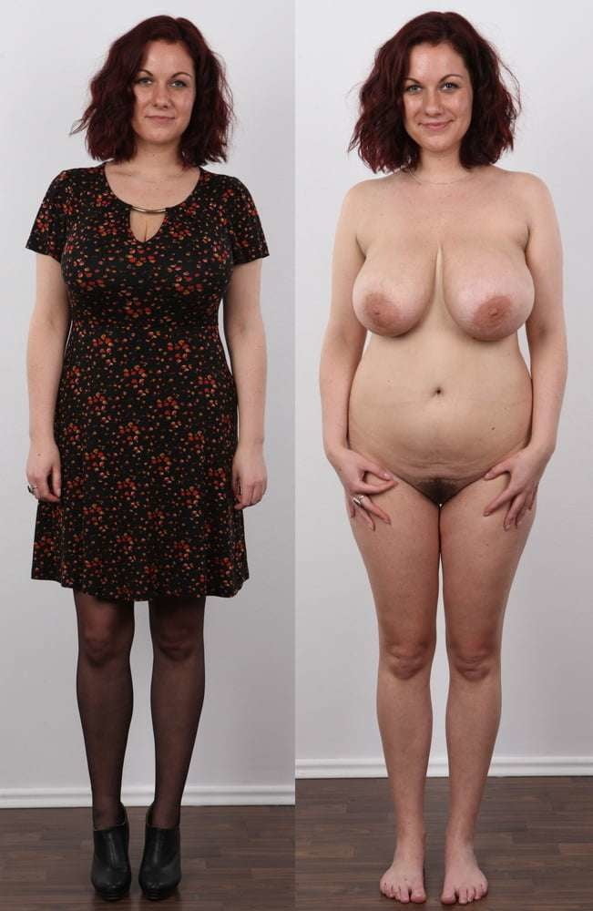 Mega-Galerie von Frauen nackt gekleidet vor nach
 #101243349