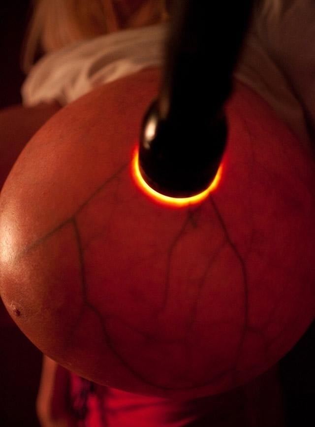 Breast transillumination test #97334951