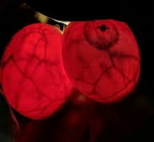 Breast transillumination test #97334959