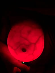 Breast transillumination test #97334960