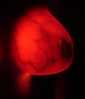Breast transillumination test #97334961