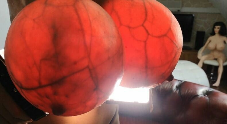 Breast transillumination test #97334963