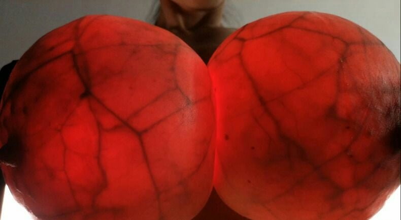 Breast transillumination test #97334964