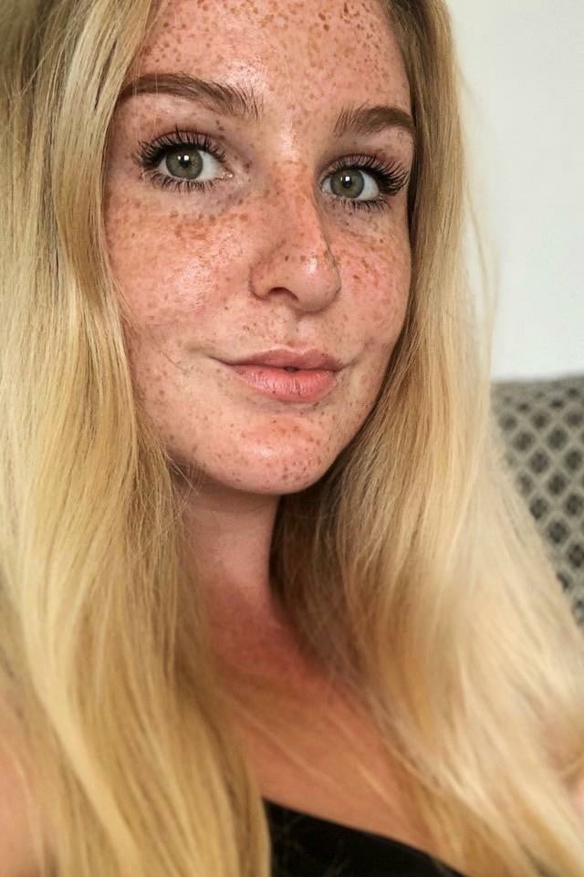 Freckles #94345038