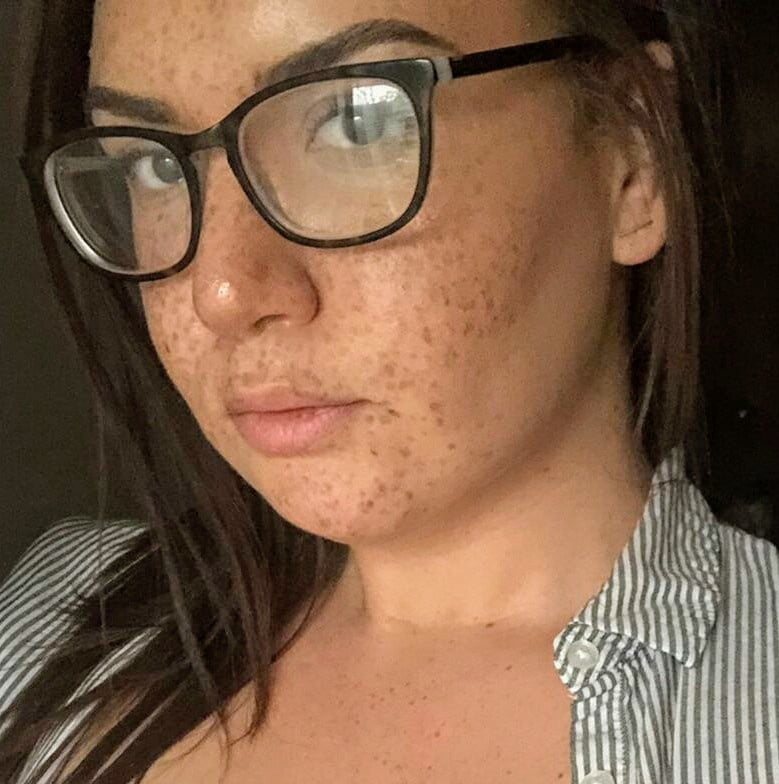 Freckles #94345201