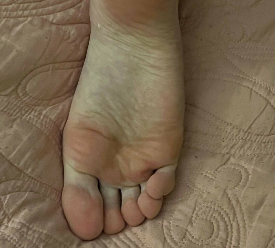 Sasa desnuda #109792646