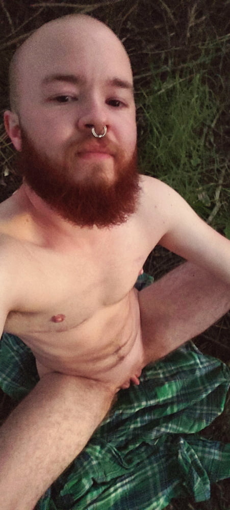 Man with pussy - FTM #107254417