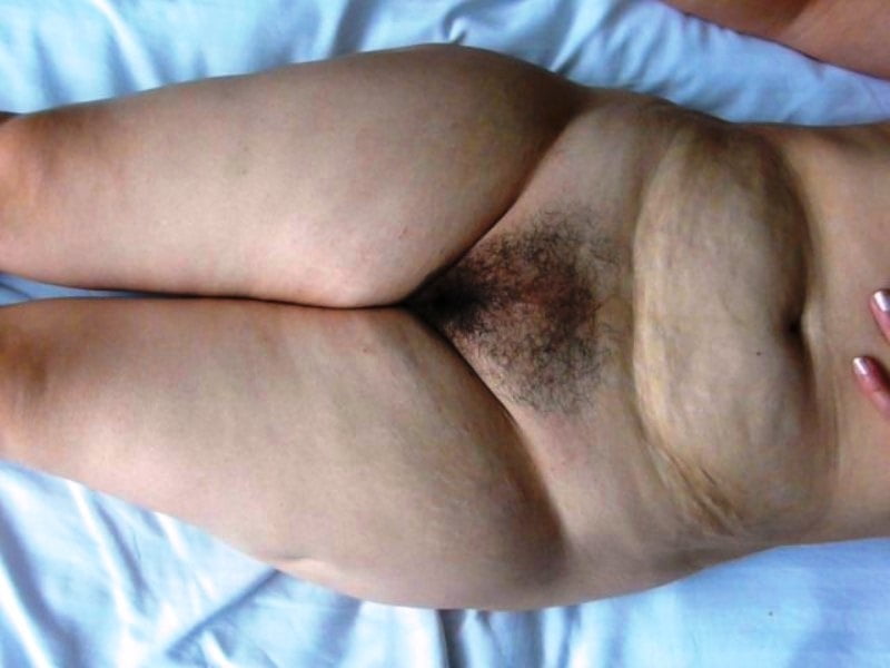 Snevla Hintern
 #102134815