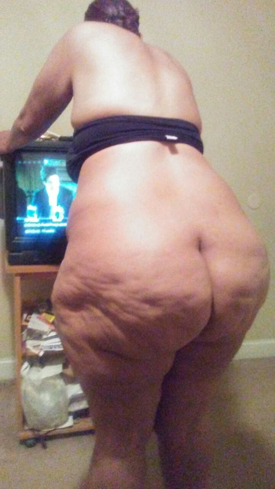 cellulite #93756118