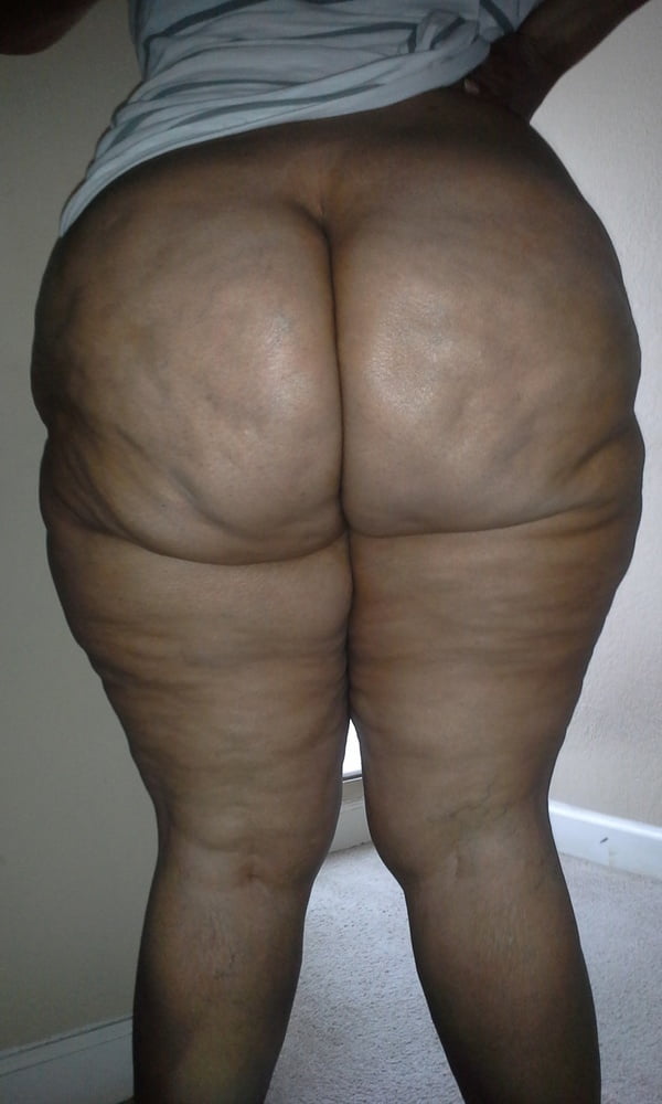 cellulite #93756124
