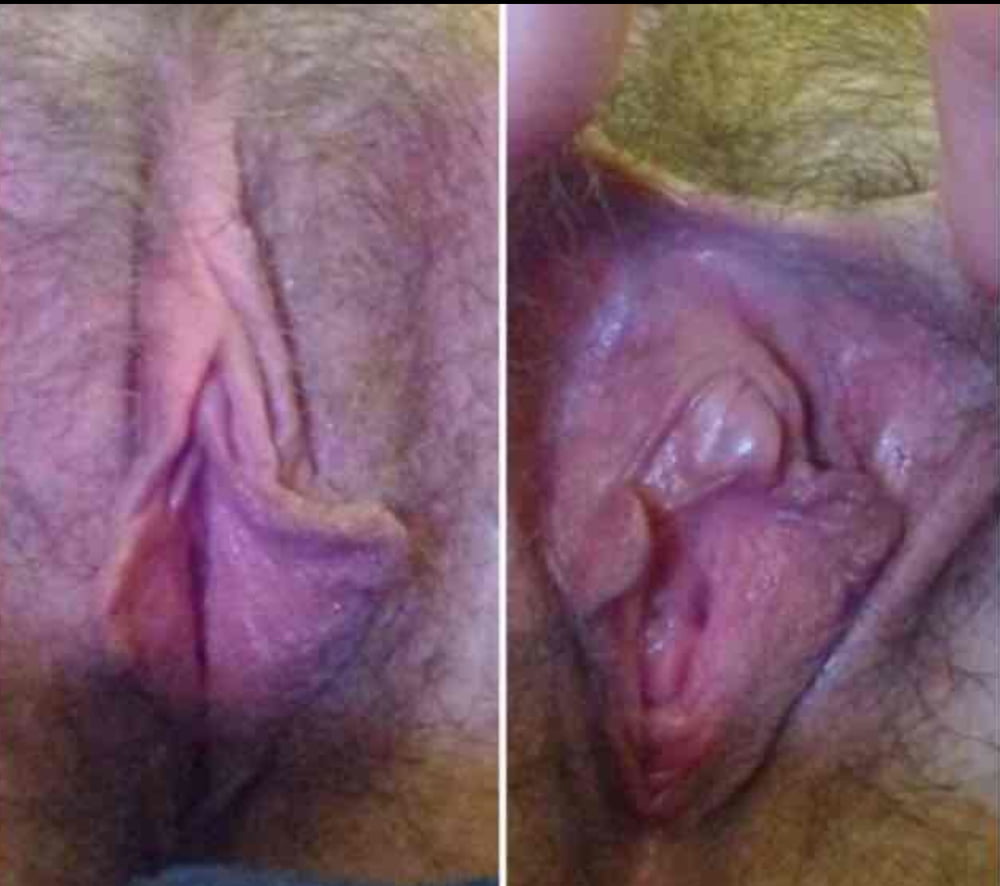 Before and after #94079016