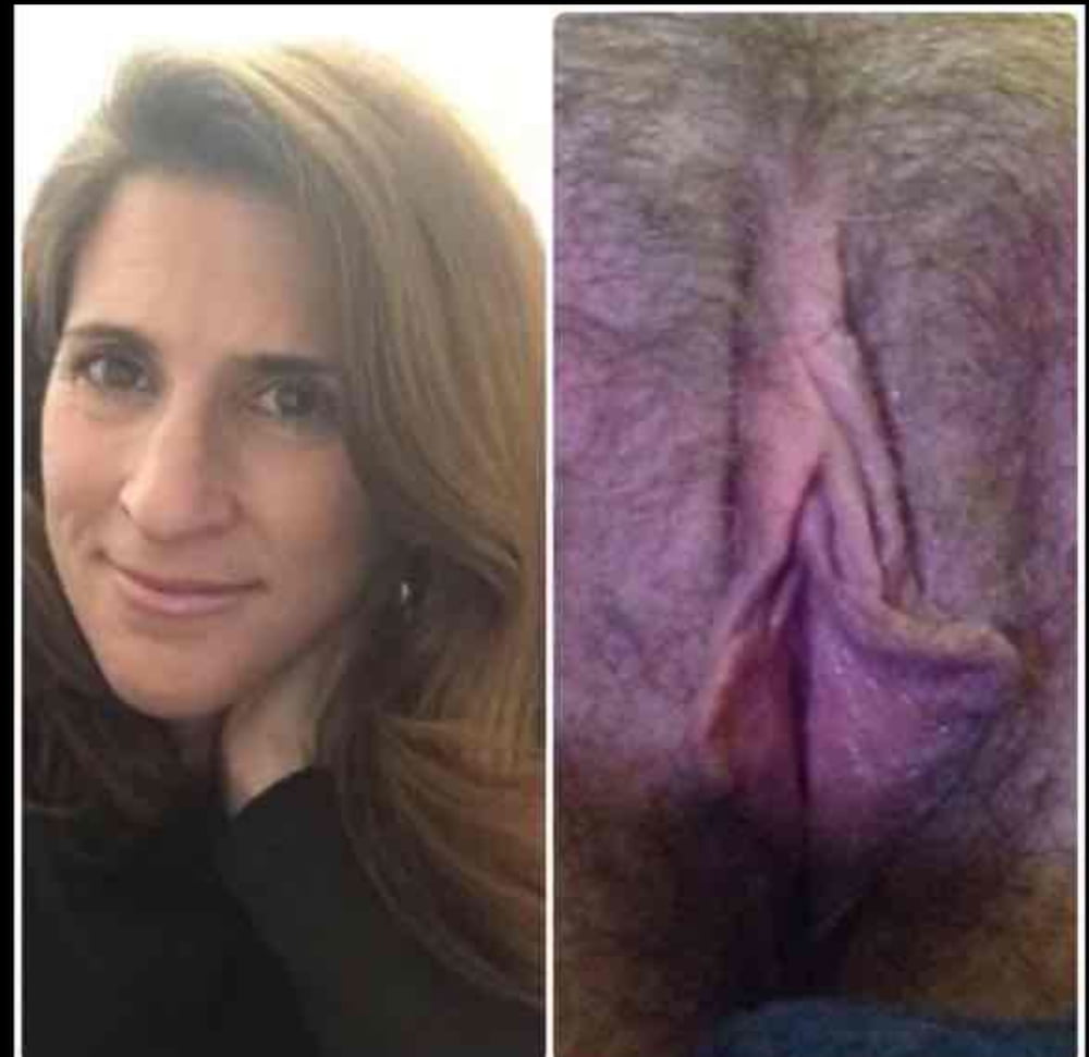 Before and after #94079022