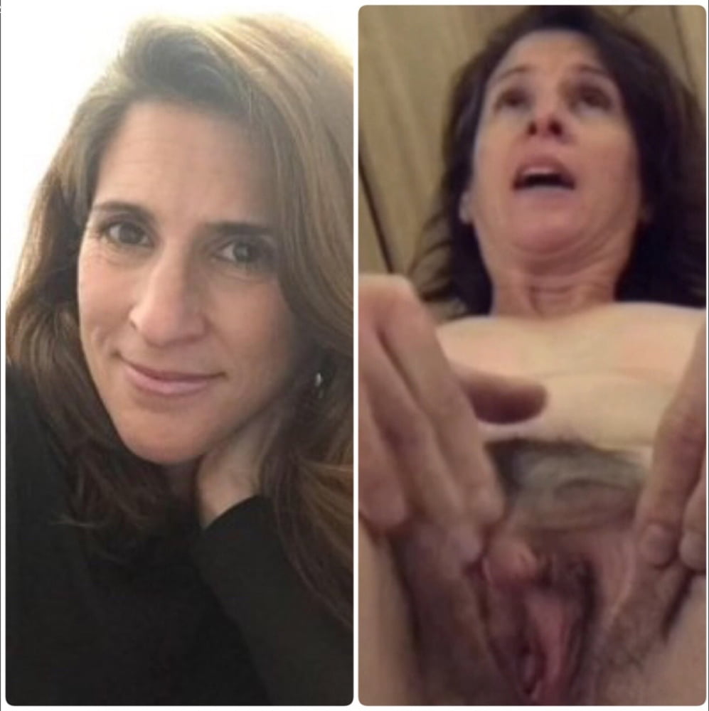 Before and after #94079031