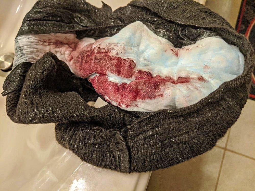 月経周期
 #94408596