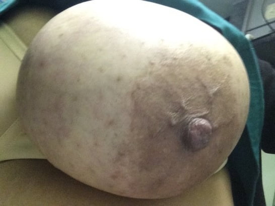 Titty Tuesday SUBMISSIONS #96206580