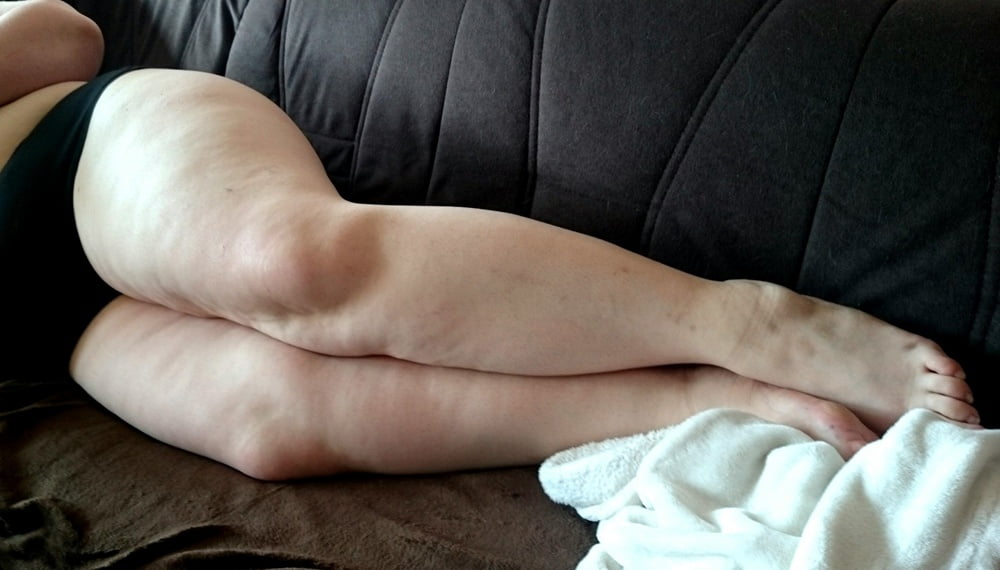 Sexy &amp; Chubby Legs 17 #87826114