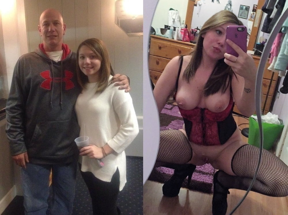 bofere and after 99 #89920680