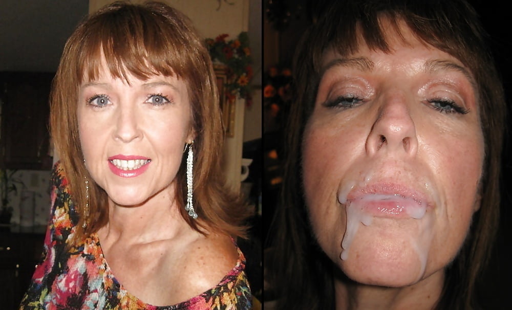 bofere and after 99 #89920700