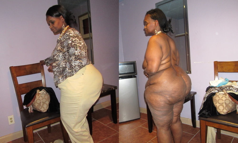 bofere and after 99 #89920758