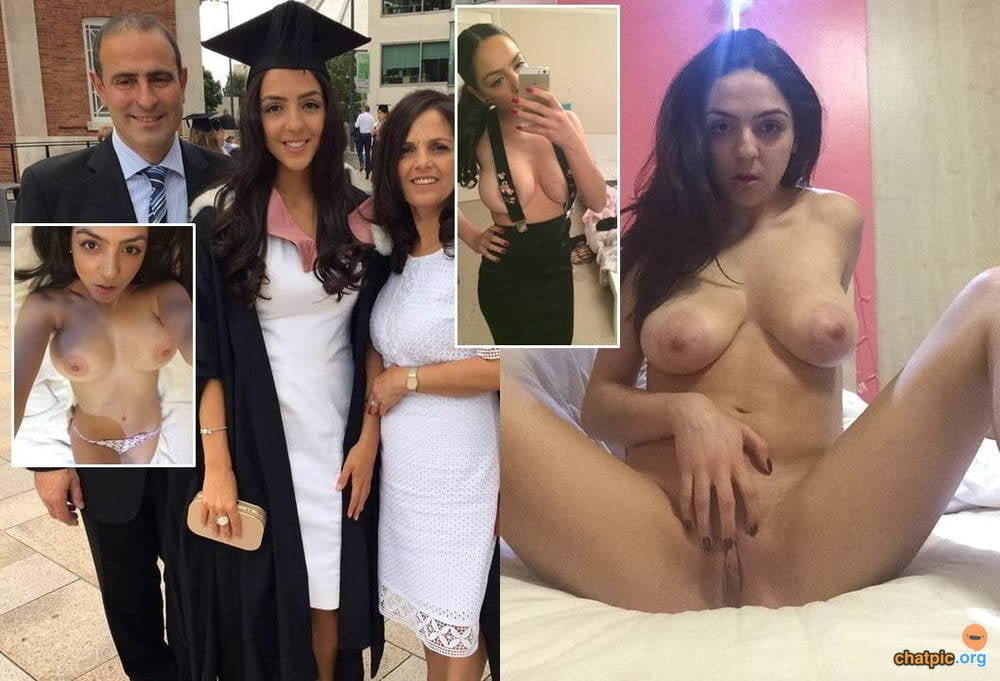 bofere and after 99 #89920773