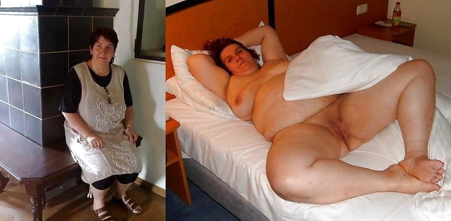 bofere and after 99 #89920794