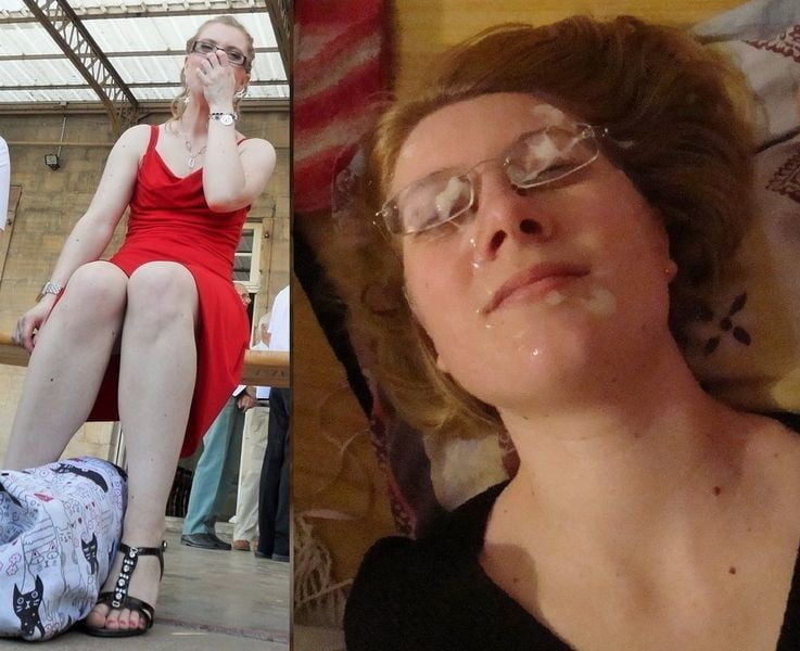 bofere and after 99 #89920862