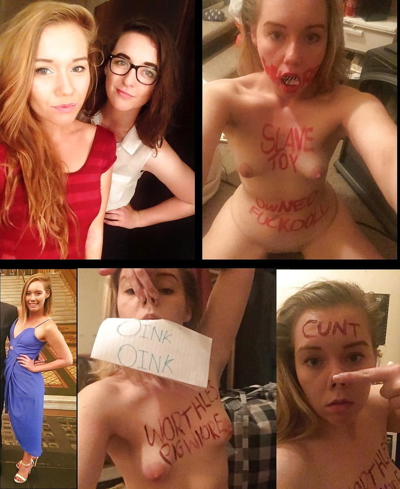 bofere and after 99 #89920865