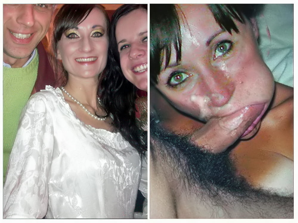 bofere and after 99 #89920871