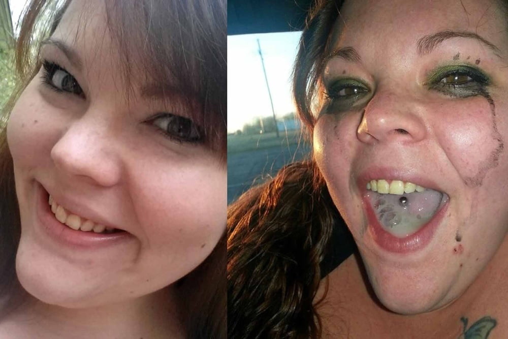 bofere and after 99 #89920880