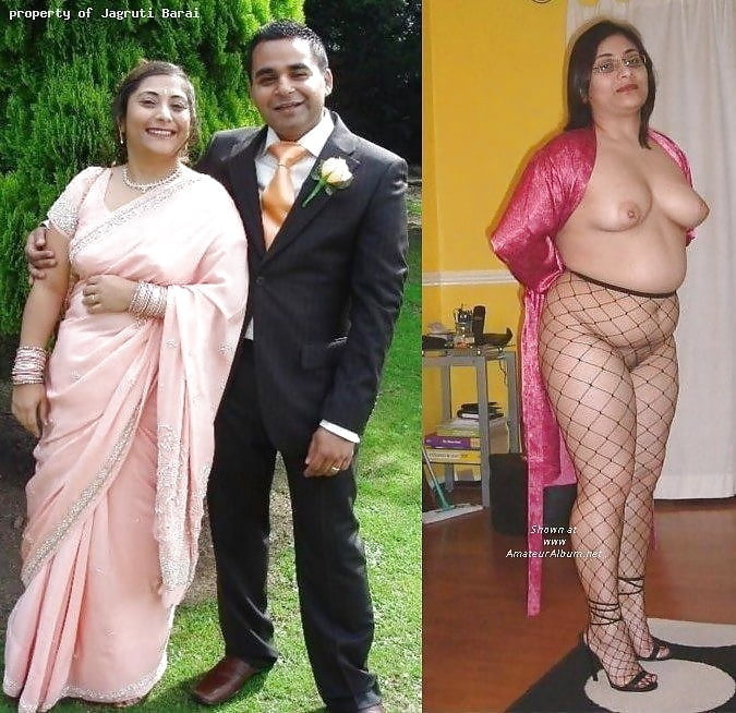 bofere and after 99 #89920887