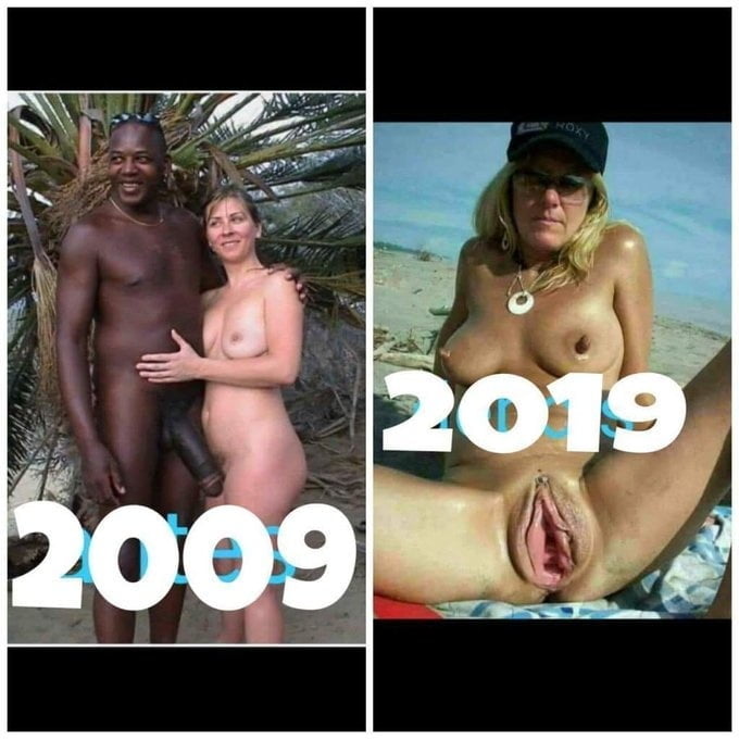 bofere and after 99 #89920891