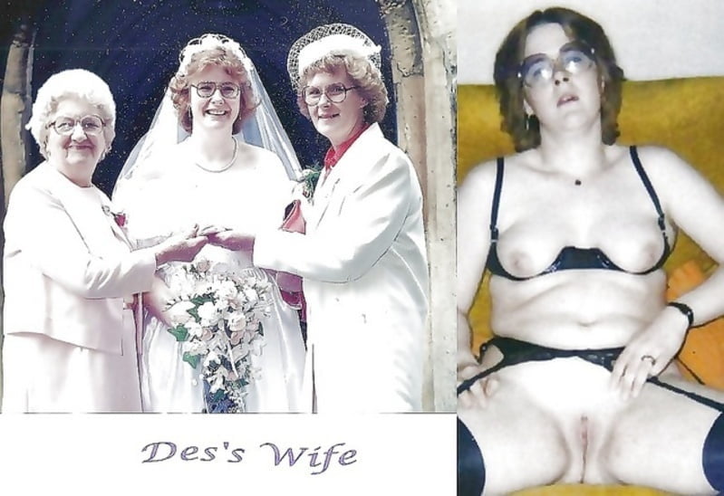 bofere and after 99 #89920921