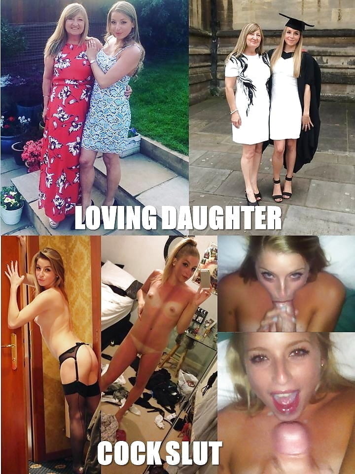 bofere and after 99 #89920931