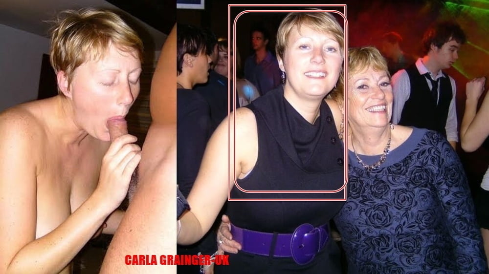 bofere and after 99 #89920968