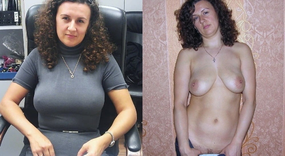 bofere and after 99 #89921028