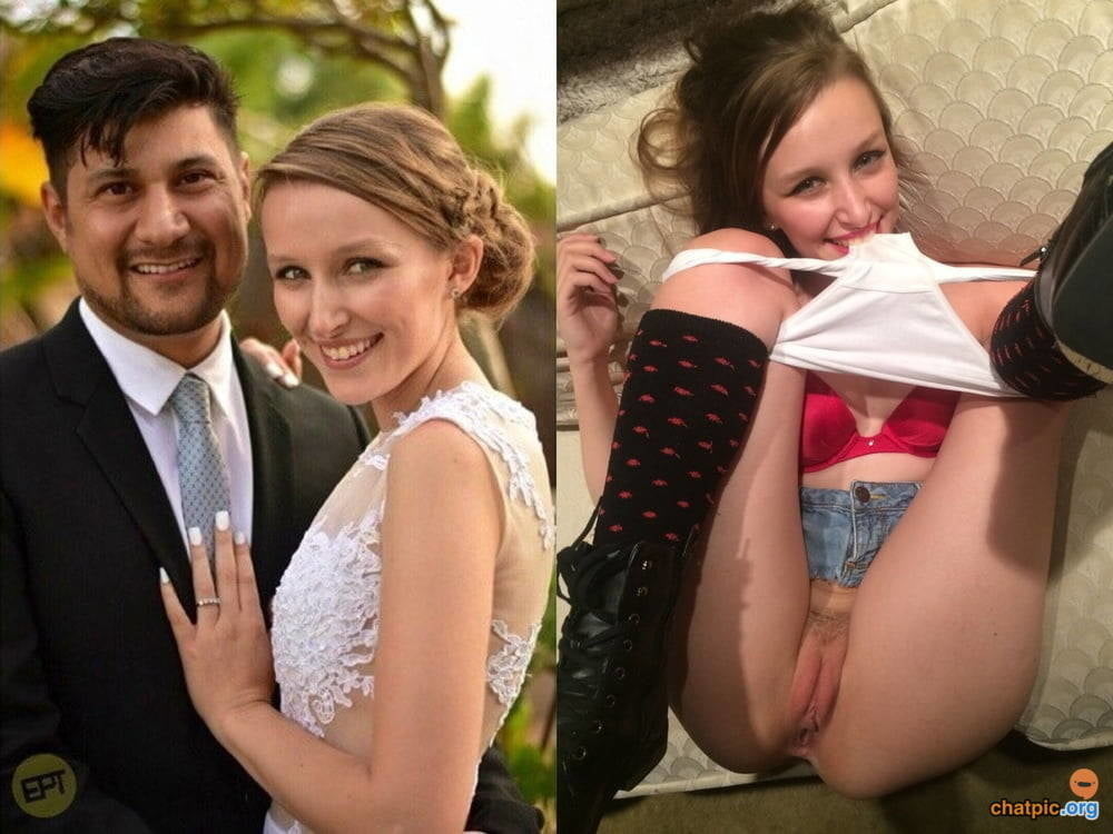 bofere and after 99 #89921034