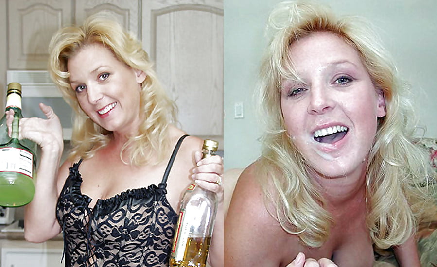 bofere and after 99 #89921046