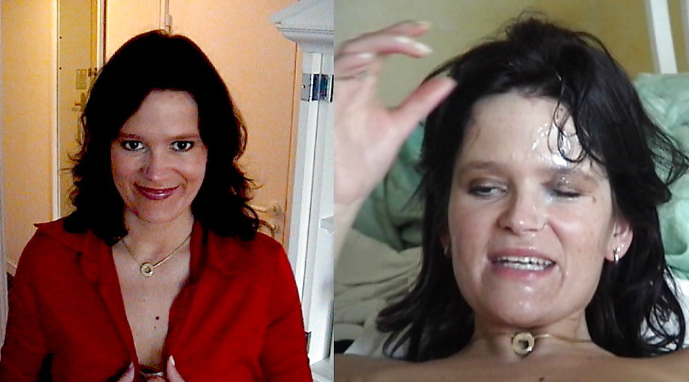 bofere and after 99 #89921055