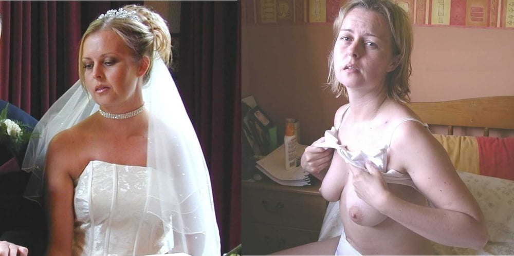 bofere and after 99 #89921086