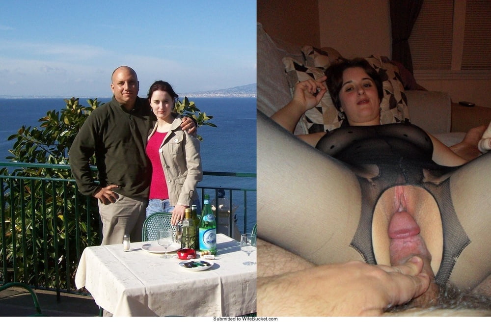 bofere and after 99 #89921110