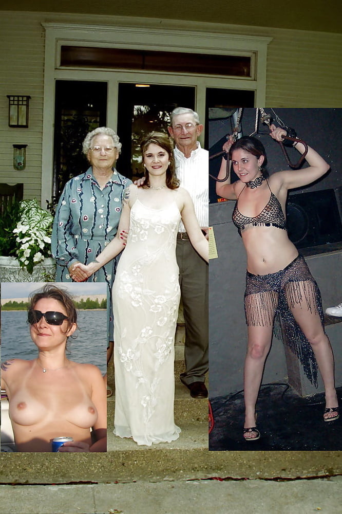 bofere and after 99 #89921152