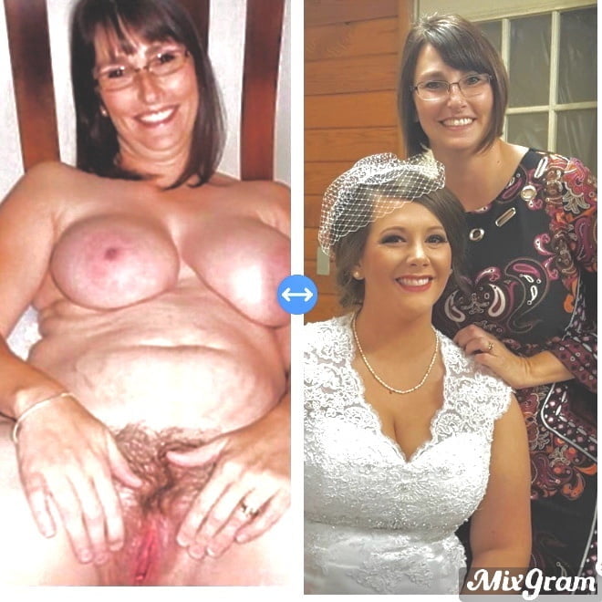 bofere and after 99 #89921167