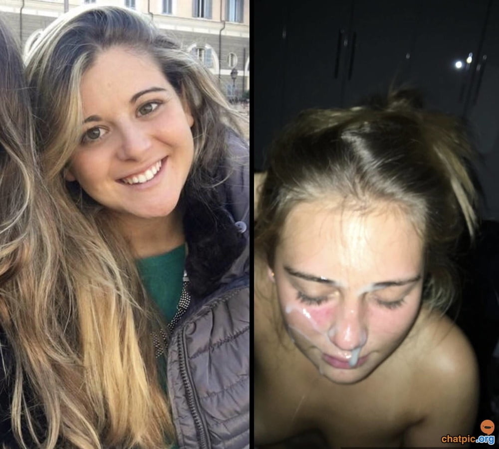 bofere and after 99 #89921173