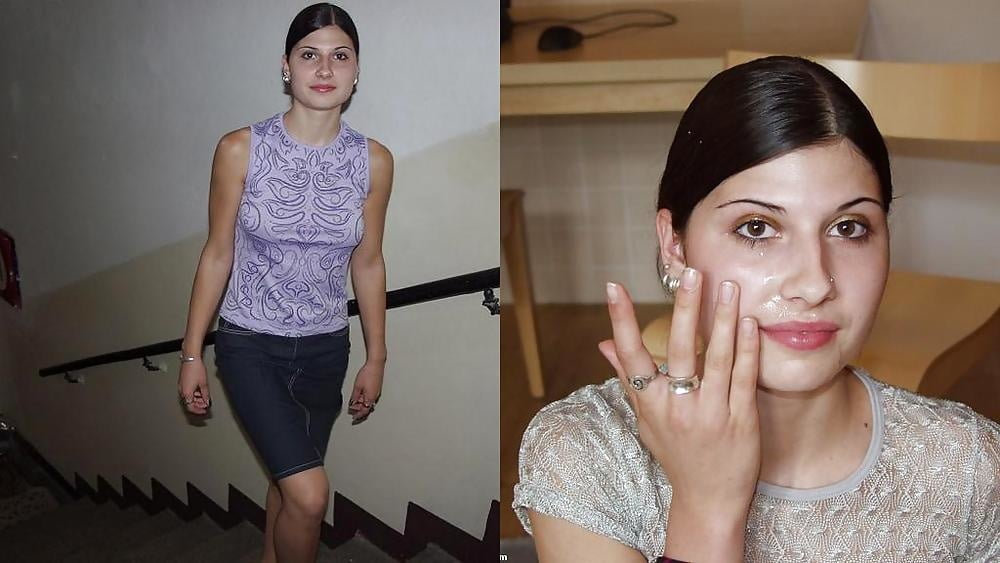 bofere and after 99 #89921242