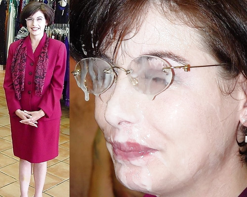 bofere and after 99 #89921248